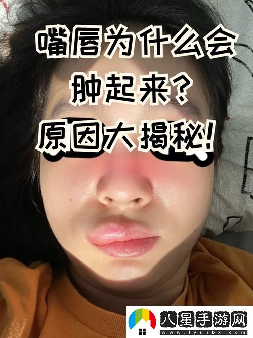 為什么上下兩張嘴都腫了
