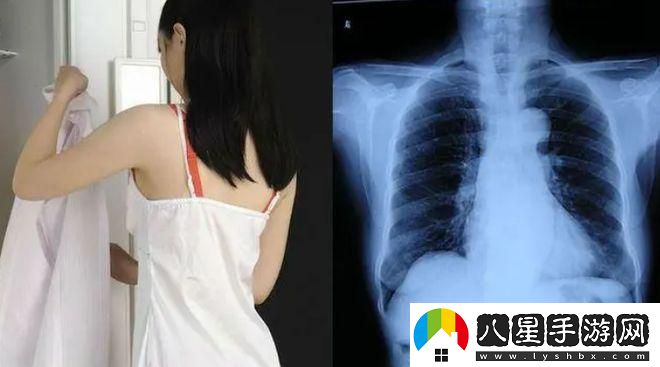 在醫(yī)學影像中